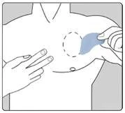 A diagram shows a male torso with a hand pointing to a dashed circle on the chest and the