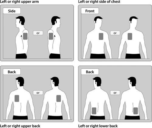 Diagrams of a man indicating application sites on the arm, side of the chest, upper and lower back, right or left side