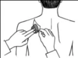 Black and white drawing of two hands applying a medicinal patch on the upper back of a person viewed from behind