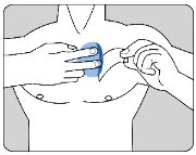 Disegno schematico di un torace dove due mani applicano un cerotto blu sulla parte superiore del petto per l'