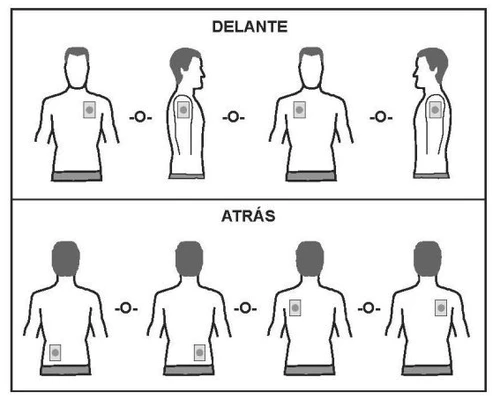 Medical diagram with human figures showing injection sites on the chest, flank, abdomen, and back, divided between anterior and posterior views
