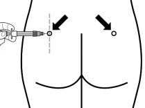 Medical diagram showing a hand gripping a syringe for a