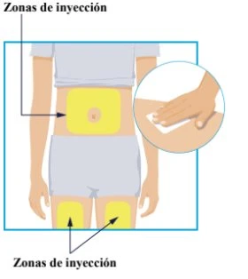 Diagramma del corpo umano che indica le zone di iniezione sull