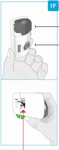 Illustrazione medica divisa in due parti che mostra una mano che impugna un dispositivo medico bianco con indicazioni grafiche e una freccia rossa