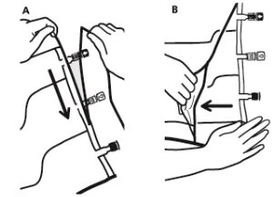 Two-step medical diagram showing the correct application of sensors from a medical device onto the skin of the arm