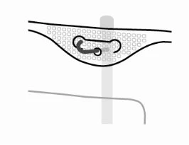 Diagramma schematico che mostra un dispositivo medico inserito sotto la pelle con una struttura a spirale e un supporto verticale grigio