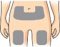 Diagram of a person's torso and legs with three gray areas indicating injection sites