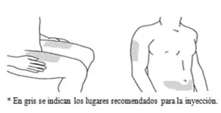 Schematic drawings of a male torso indicating gray areas for