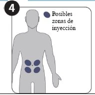 Diagram of a stylized human body with four dark areas on