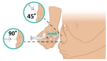 Diagramma che mostra l'iniezione sottocutanea con ago inserito perpendicolarmente alla pelle