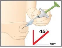 Illustrazione medica che mostra una mano che tiene una siringa per iniettare un farmaco nel corpo con un angolo di 45 gradi rispetto alla pelle
