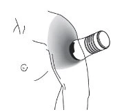 Schematic drawing showing a medical device applied on the upper arm of a person