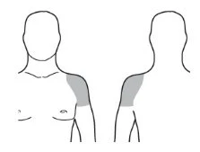 Schematic diagram of the male torso showing two views, front and back, with the left shoulder highlighted in dark gray