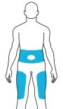 Stylized human body diagram with blue-highlighted areas on the abdominal region and upper thighs of both legs