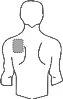 Disegno stilizzato del busto di un uomo con un'area rettangolare grigia che indica il punto di applicazione del farmaco sulla spalla destra