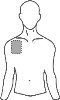Schematic drawing of the upper body of a man with a rectangular patch applied to the upper right shoulder