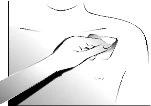 Black and white drawing showing a hand applying a patch or dressing to the upper chest of a person
