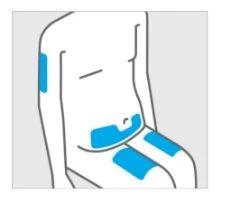 Stylized diagram of a human torso with four blue rectangular areas positioned on the back, on the