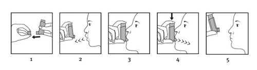 Sequence of five illustrations showing how to position and use a medical device for