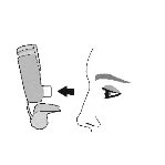 Schematic drawing showing a medical device being brought toward the profile of a person's nose via a black arrow