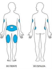 Diagramma del corpo umano che mostra aree blu su addome, braccia e cosce nella vista frontale e su braccia e fianchi nella vista posteriore