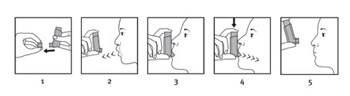 Sequenza di cinque illustrazioni che mostrano come posizionare l'