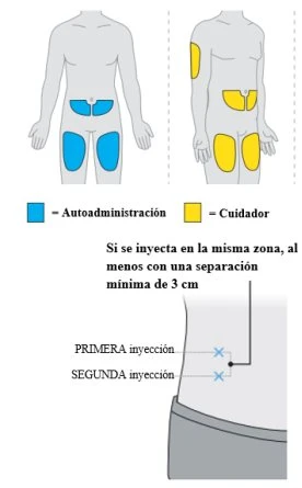 Medical diagram with human figures showing blue injection sites for