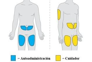 Diagram of two human figures showing blue injection sites for