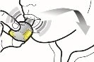 A hand presses a medical device against the skin with a gray arrow indicating downward movement for
