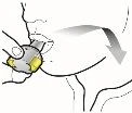 Schematic drawing showing a hand pressing a medical device against the skin with an arrow indicating downward movement