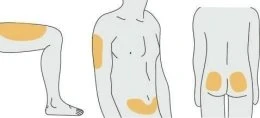 Three diagrams of a human body showing application areas highlighted in yellow on the thigh, arm, and abdomen