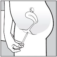 Disegno schematico di una mano che inserisce un applicatore sottile nella cavità vaginale di una figura femminile di profilo