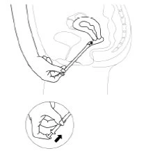 Schematic drawing showing the