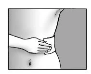 Disegno schematico di una mano che applica una fascia o un dispositivo medico sulla zona dell'avambraccio