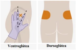 Medical diagram showing two intramuscular injection sites on the buttock, labeled ventrogluteal and dorsogluteal with graphic indicators