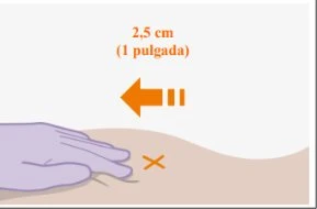Medical illustration with an orange arrow indicating a distance of 2.5 cm from an orange cross placed on a light skin surface