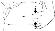 Disegno schematico di una mano che pizzica la pelle dell'area di iniezione