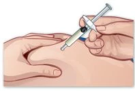 A hand holding a syringe with needle and liquid as it is inserted into the fatty tissue of the abdomen