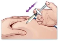 A hand holding a syringe at an angle inserting it into the buttock of a patient while another hand stabilizes the area
