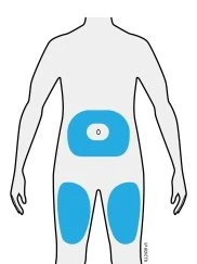 Schema stilizzato di un corpo umano visto di fronte con tre aree azzurre che indicano la zona dell