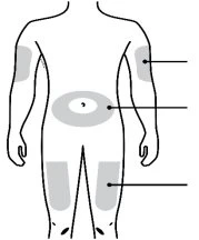 Schema del corpo umano con aree grigie evidenziate su braccia, addome e cosce collegate da linee nere a destra e sinistra