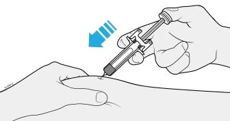A hand holding a syringe injecting liquid under the skin of the arm, with a blue arrow indicating the direction of movement