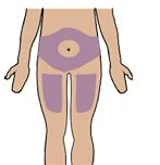 Diagramma di un torso umano con tre aree colorate in viola sull'addome per le iniezioni sottocutanee
