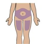 Diagramma di un corpo umano che mostra aree colorate in viola sull'addome per le iniezioni sottocutanee