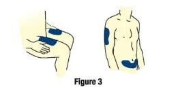 Schematic drawings of a human body indicating the drug injection sites on the thigh and torso, with highlighted blue areas