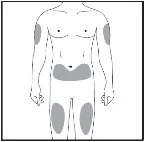 Male body diagram with gray areas indicating injection sites on the arms and