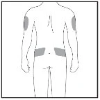 Schematic of the human body viewed from the back with gray areas highlighted on the arms and hips to indicate drug administration sites