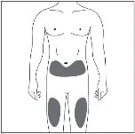 Schematic of the male human body with dark gray areas indicating injection sites