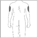 Schematic drawing of the human body viewed from the back, with two gray highlighted areas on the upper part of both arms