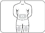 Disegno schematico di un busto maschile con aree grigie evidenziate sulle spalle e sulla schiena